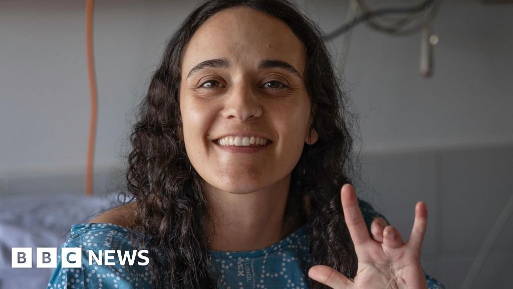 Hostage says scars show ‘strength’ ahead of surgery