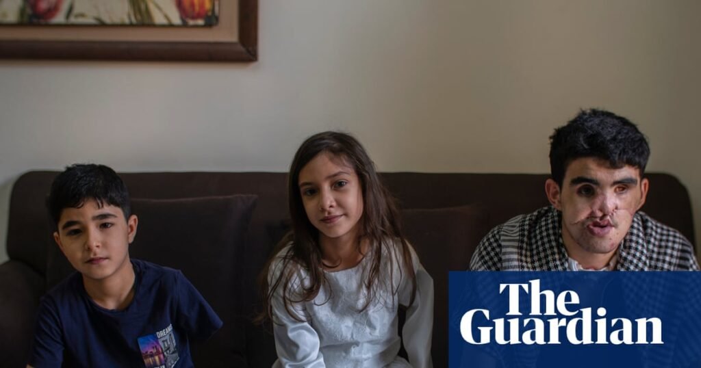 ‘We pray a visa comes before death’: Gaza’s injured children left in limbo | Gaza